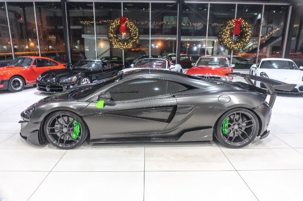 Used-2016-McLaren-570S-Coupe-MSRP-274K-60K-in-UPGRADES--VORSTEINER-BODY-KIT